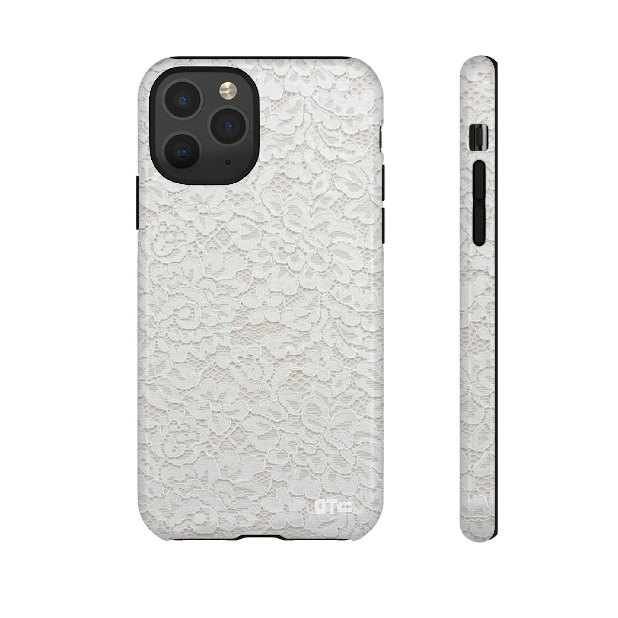 White Lace Protective Case