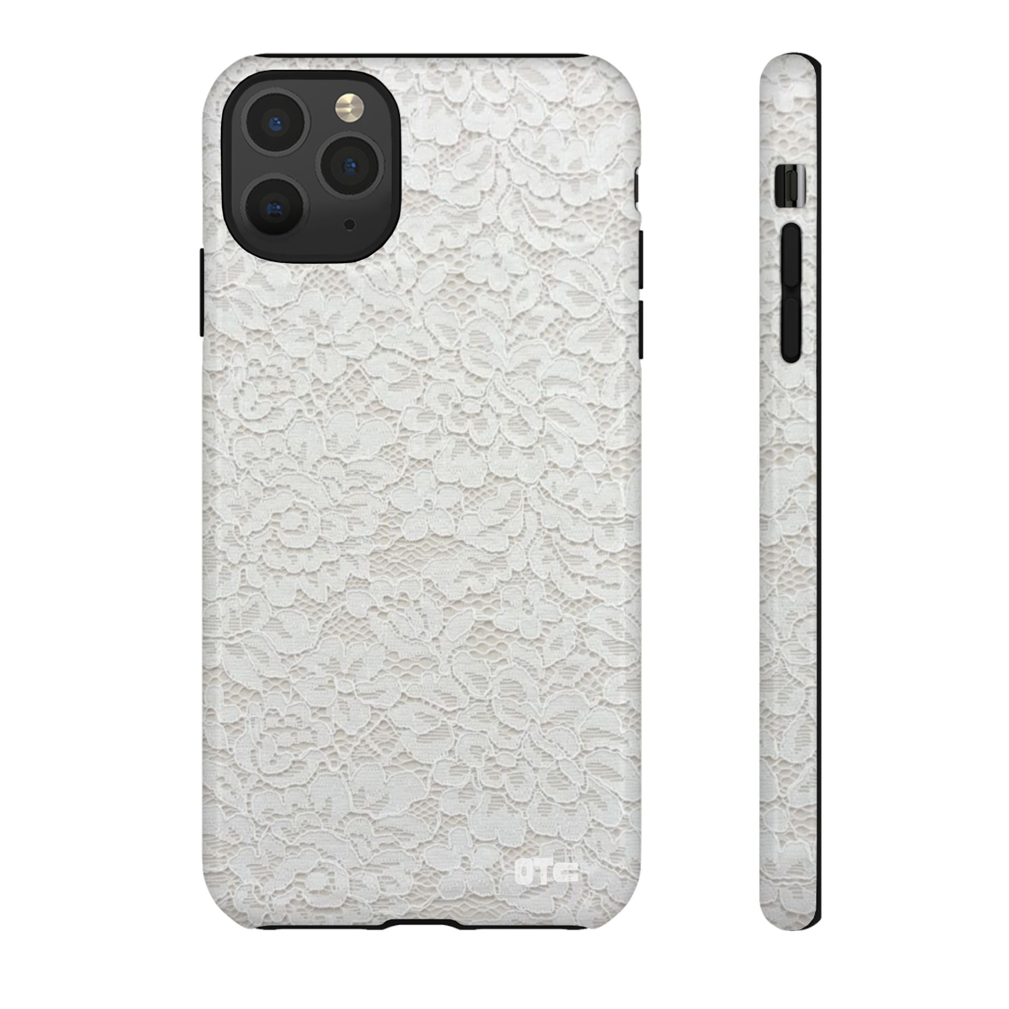 White Lace Protective Case